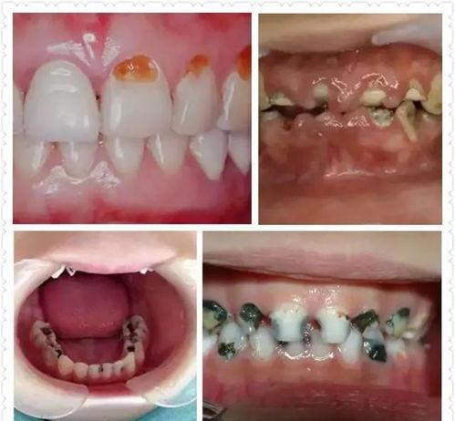 哪里种植国产牙好呢视频